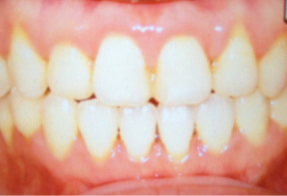 image-20120310014420.png
